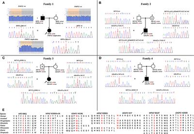 One PMP22/MPZ and Three MFN2/GDAP1 Concomitant Variants Occurred in a Cohort of 189 Chinese Charcot-Marie-Tooth Families